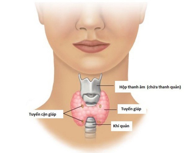Hiểu đúng về ung thư tuyến giáp