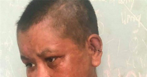 Kon Tum: Thân thể, mặt của cô gái chi chít vết thương, nghi bị chủ nhục hình?