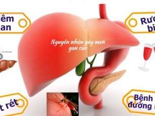 Men gan cao và những điều bạn chưa biết