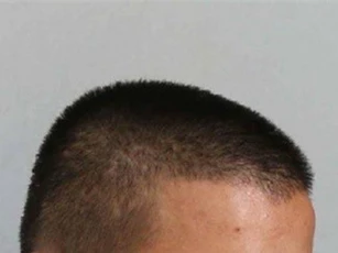 Bắt giữ nghi phạm dùng súng bắn người gây xôn xao tại Quảng Bình