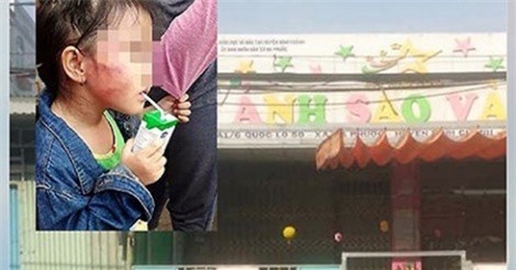 Đưa bảo mẫu về trụ sở Công an để làm rõ hành vi bạo hành