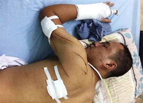 Xua đuổi tàu cát xâm hại đầm tôm, chủ đầm bị chém nguy kịch