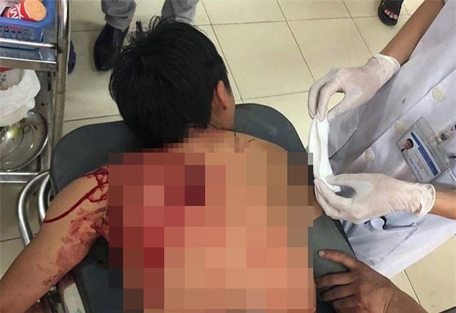 Đánh nhau tại đám cưới, nam thanh niên bị chém gục tại chỗ