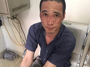 Phát hiện đối tượng sử dụng ma túy đá, dị ứng nổi lên ở mặt